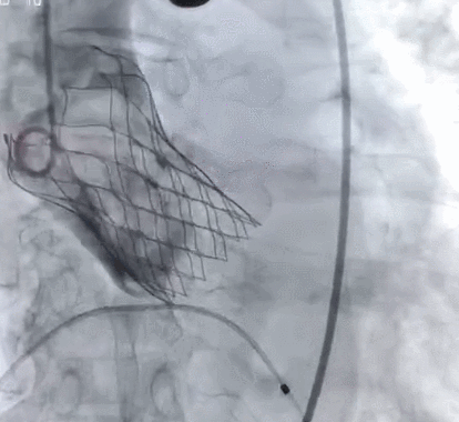 1607909822514020346.gif 8.gif