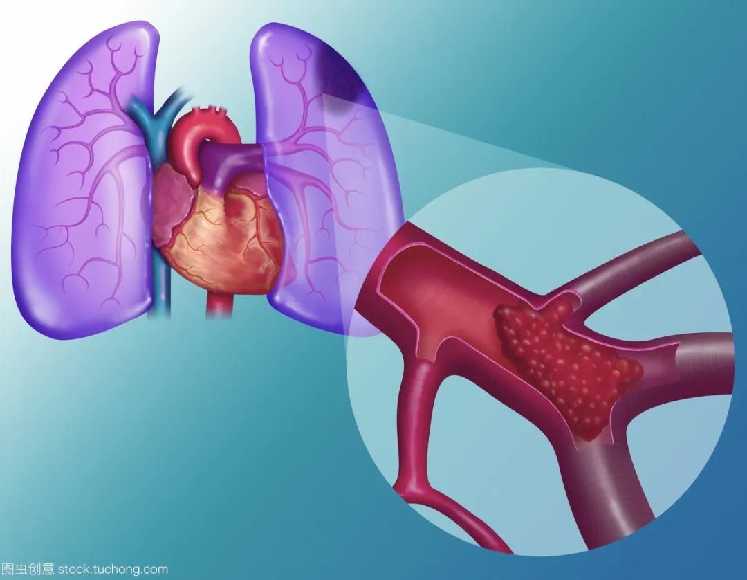 1612929989625097973.jpg 1.jpg