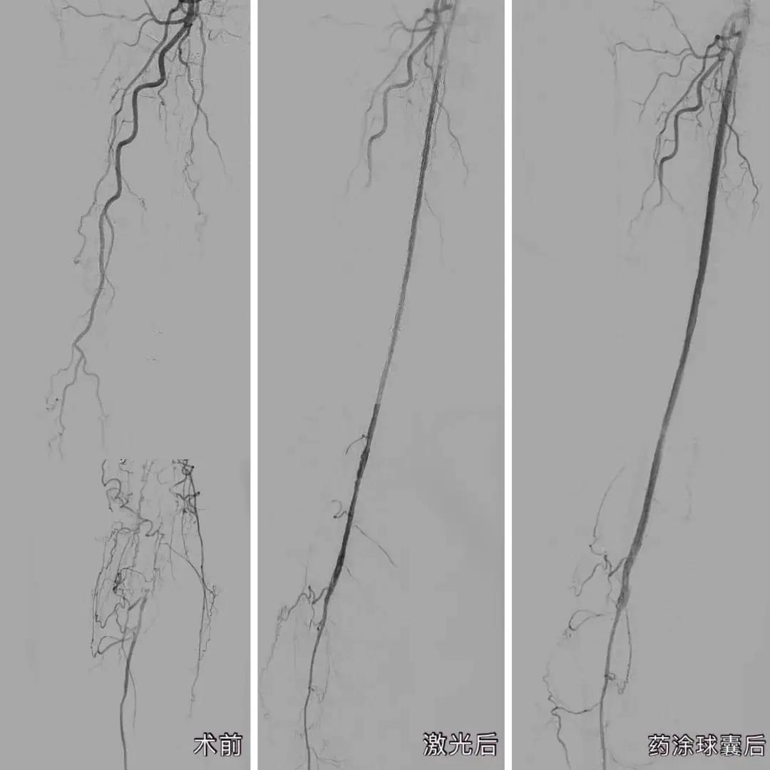 1617353397961062089.jpg 4.jpg