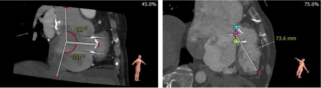 1622714341261086545.png 3.png