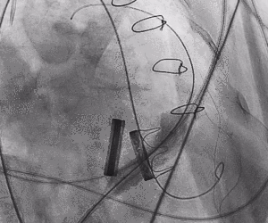 1622714559834037176.gif 2.gif