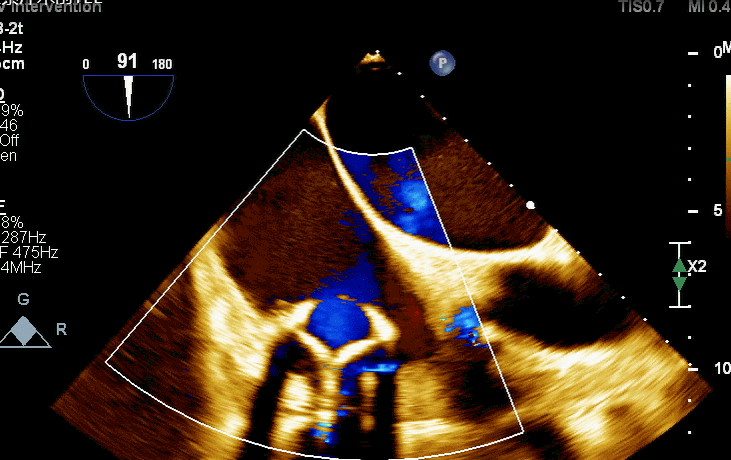 1622714817300060161.gif 4.gif