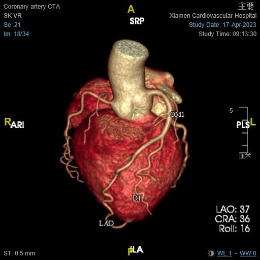 1687314966465054.jpg 夏4.jpg