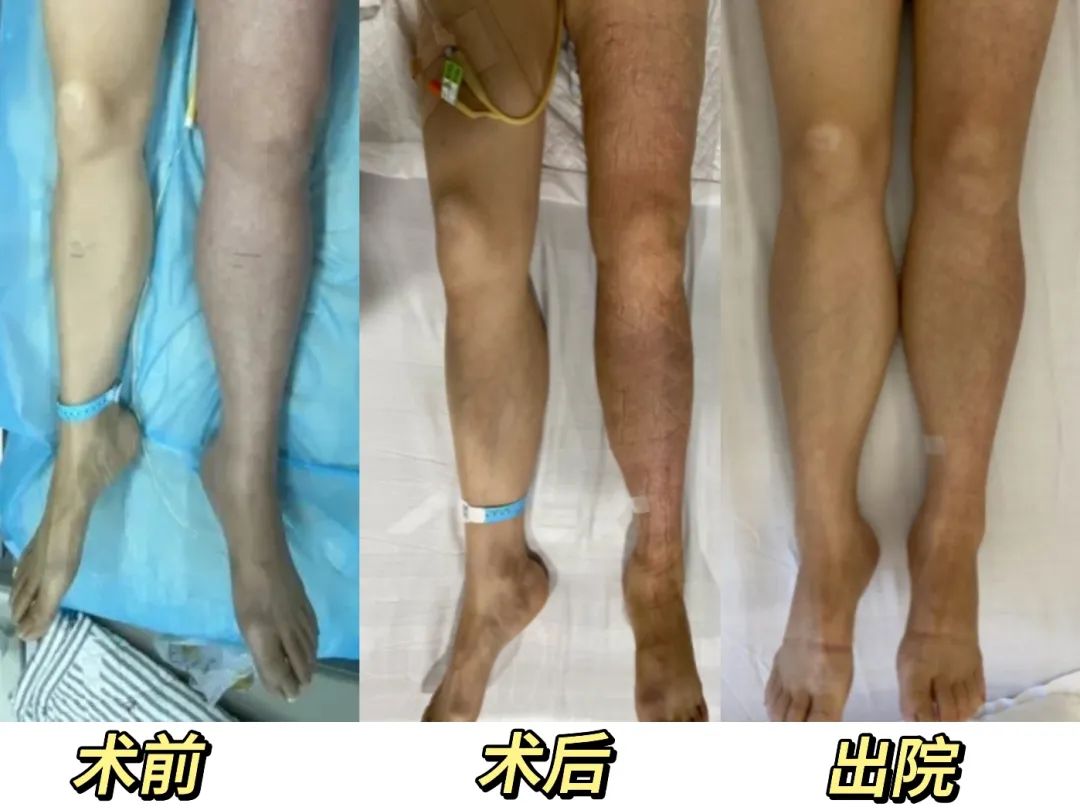 1697596461309077.jpg 血栓6.jpg